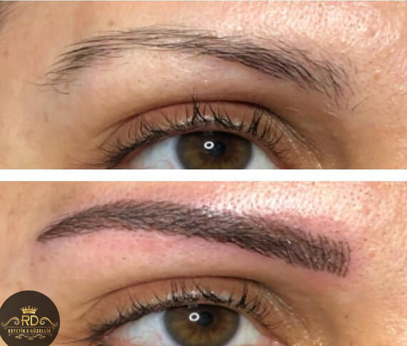 Microblading