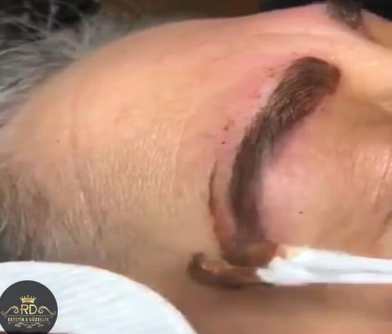 Kalıcı Makyaj Silme